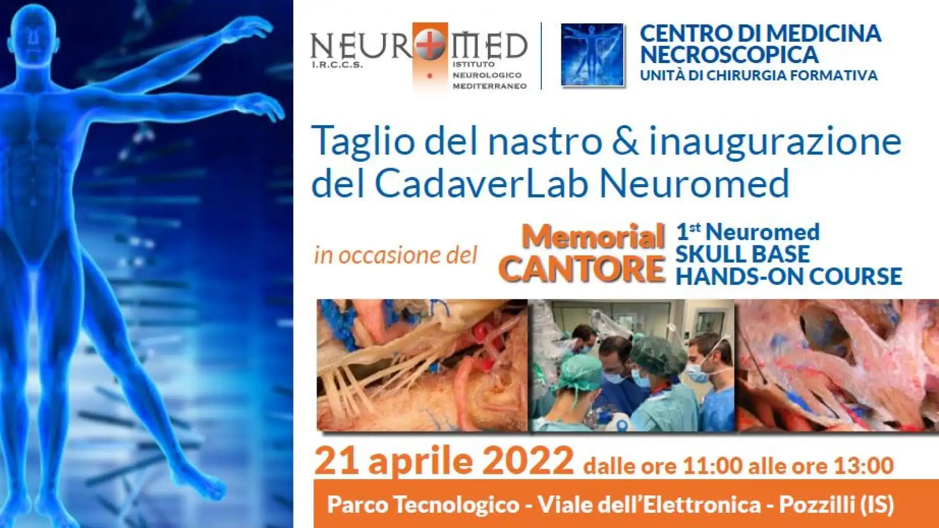 Neurochirurgia Neuromed: ricordare il professor Cantore nel segno della formazione di eccellenza. Giovedì 21 aprile inaugurazione del centro di medicina Necroscopica