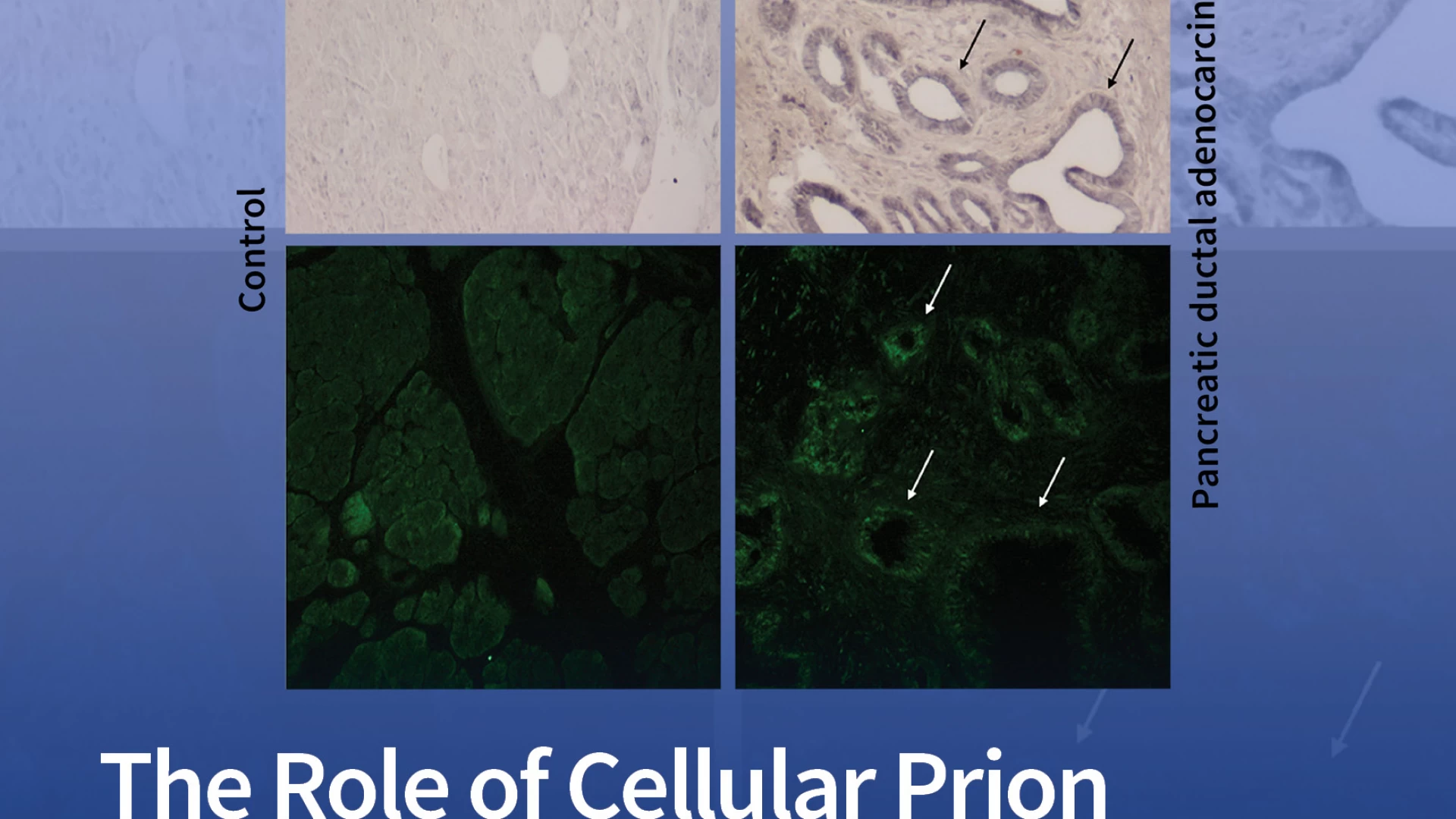 Neuromed: lo studio sui prioni come elementi cruciali dei tumori conquista la copertina di Cancers