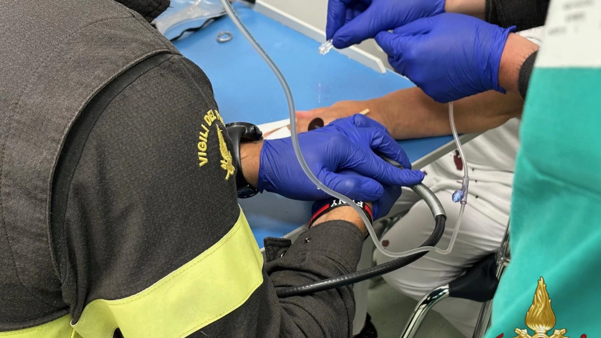 ISERNIA: Si frattura le dita della mano e l'anello non si sfila: lo tagliano i Vigili del Fuoco al pronto soccorso